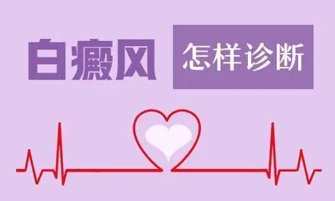 【医院榜单】上海地区哪家医院治疗白癜风专业-白癜风的临床表现和诊断
