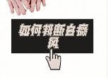 {白癜风总榜}上海治疗白癜风医院排名-白癜风的血液检查要注意什么