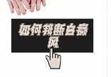 [2023公开]上海白癜风医院有哪些-白癜风的诊断方法是什么